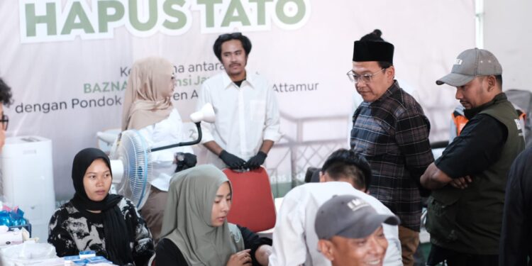 Program “Jejak Baru” dari BAZNAS Jabar Hadirkan Layanan Hapus Tato Gratis
